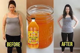 The Secret Power of Apple Cider Vinegar in Weight Loss